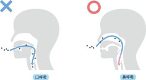 成田市公津の杜の歯医者、はばたき矯正・こども歯科の口呼吸についての解説