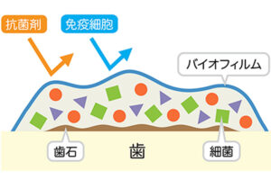 成田市公津の杜の歯医者、はばたき矯正・こども歯科のフロスについての解説