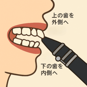 成田市公津の杜の歯医者、はばたき矯正・こども歯科で矯正治療と楽器演奏についての解説