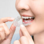 成田市公津の杜の歯医者、はばたき矯正・こどもで、マウスピース矯正とホワイトニングを同時にできる？について解説