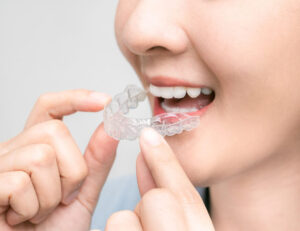 成田市公津の杜の歯医者、はばたき矯正・こどもで、マウスピース矯正とホワイトニングを同時にできる？について解説